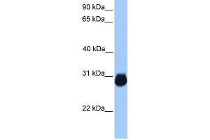 WB Suggested Anti-IGFBP7 Antibody Titration:  0. (IGFBP7 anticorps  (C-Term))