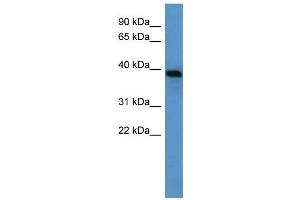 WB Suggested Anti-Ambp Antibody Titration:  0. (AMBP anticorps  (N-Term))