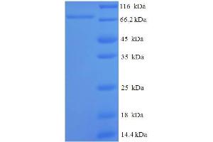 SDS-PAGE (SDS) image for ATP-Dependent RNA Helicase A (DHX9) (AA 325-840), (partial) protein (His-SUMO Tag) (ABIN5711235)