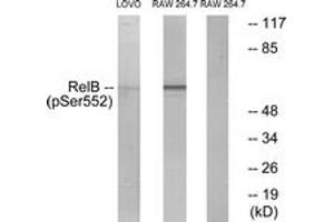 Western blot analysis of extracts from LOVO cells and RAW264. (RELB anticorps  (pSer573))