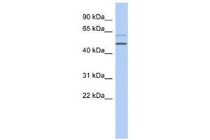 TBC1D10C antibody used at 1 ug/ml to detect target protein. (Carabin anticorps  (N-Term))