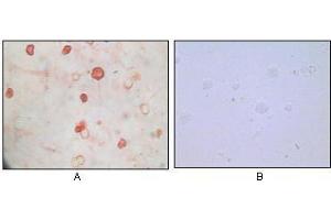 Immunocytochemistry analysis of TPA induced BCBL-1 cells (A) and uninduced BCBL-1 cells (B) using KSHV K8α mouse mAb with AEC staining. (KSHVK8a anticorps)