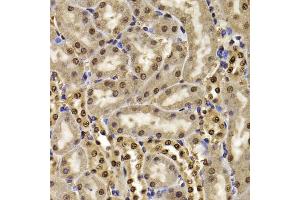 Immunohistochemistry of paraffin-embedded mouse kidney using HIRIP3 antibody (ABIN5974221) at dilution of 1/100 (40x lens). (HIRIP3 anticorps)