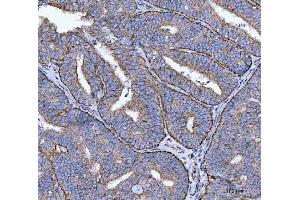IHC analysis of Calnexin/CANX using anti-Calnexin/CANX antibody (ABIN7602289).