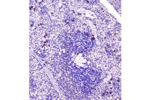 IHC analysis of RASAL1 using anti-RASAL1 antibody (ABIN6719367). (RASAL1 anticorps  (AA 721-798))