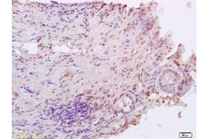 Formalin-fixed and paraffin embedded rat colitis labeled with Anti XRCC4 Polyclonal Antibody, Unconjugated (ABIN1386856) at 1:200 followed by conjugation to the secondary antibody and DAB staining