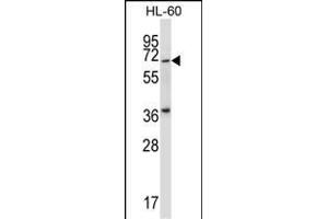 Mouse Pkmyt1 Antibody (N-term) (ABIN657999 and ABIN2846944) western blot analysis in HL-60 cell line lysates (35 μg/lane). (PKMYT1 anticorps  (N-Term))