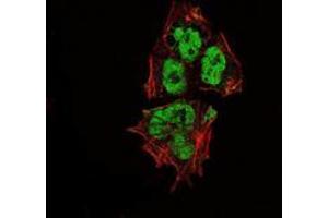 Immunofluorescence analysis of NTERA-2 cells using SOX2 mouse mAb (green). (SOX2 anticorps)