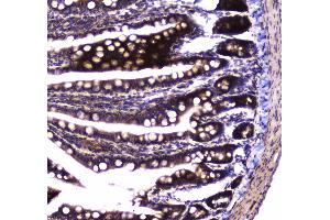 IHC analysis of SDHB using anti-SDHB antibody .