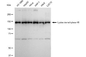 Western blotting analysis using Lysine demethylase 4B antibody (ABIN7799302).