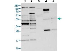 Western blot analysis of Lane 1: RT-4, Lane 2: U-251 MG, Lane 3: Human Plasma, Lane 4: Liver, Lane 5: Tonsil with CCDC34 polyclonal antibody  at 1:250-1:500 dilution. (CCDC34 anticorps)