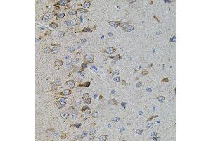 Immunohistochemistry of paraffin-embedded rat brain using MAPK11 antibody. (MAPK11 anticorps)