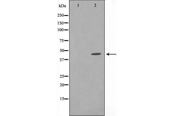 Cyclin-Dependent Kinase 15 (ALS2CR7) (Internal Region) anticorps