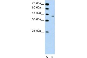 Western Blotting (WB) image for anti-DEAH (Asp-Glu-Ala-His) Box Polypeptide 30 (DHX30) antibody (ABIN2461364) (DHX30 anticorps)