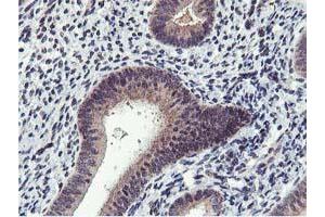 Immunohistochemical staining of paraffin-embedded Human endometrium tissue using anti-MIER2 mouse monoclonal antibody. (MIER2 anticorps  (AA 1-296))