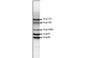 Western Blotting (WB) image for anti-Nucleoporin 98kDa (NUP98) (AA 1-466) antibody (ABIN2452066) (NUP98 anticorps  (AA 1-466))