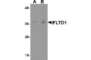 Western blot analysis of IFLTD1 in rat liver tissue lysate with IFLTD1 antibody at (A) 1 and (B) 2 µg/mL. (PAS1C1 anticorps  (Middle Region))