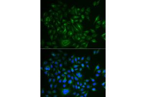 Immunofluorescence analysis of HeLa cells using BAMBI antibody (ABIN5973916). (BAMBI anticorps)
