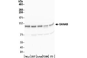 Western Blotting (WB) image for anti-Glucosidase, Alpha, Neutral AB (GANAB) (AA 200-250) antibody (ABIN7449883)