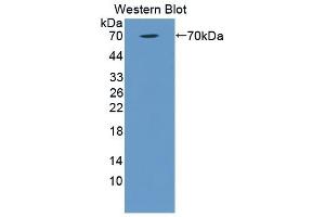 Detection of Recombinant C1qR1, Human using Polyclonal Antibody to Complement Component 1, Q Receptor (C1qR1) (CD93 anticorps  (AA 227-493))