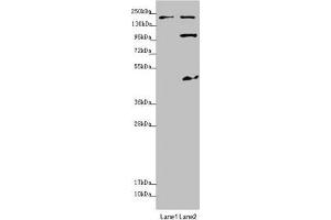 Western blot All lanes: MYO5B antibody at 1. (MYO5B anticorps  (AA 1440-1690))