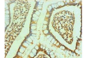 Immunohistochemical of paraffin-embedded human small intestine using ABIN7151798 at dilution of 1:200