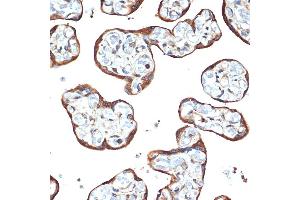 Immunohistochemistry of paraffin-embedded human placenta using STK39 Rabbit mAb (ABIN1682890, ABIN3015922, ABIN3015923 and ABIN7101461) at dilution of 1:100 (40x lens).