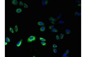 Immunofluorescent analysis of HepG2 cells using ABIN7164501 at dilution of 1:100 and Alexa Fluor 488-congugated AffiniPure Goat Anti-Rabbit IgG(H+L)