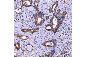 IHC analysis of TOM1L1 using anti-TOM1L1 antibody (ABIN7602631). (TOM1L1 anticorps  (AA 9-448))