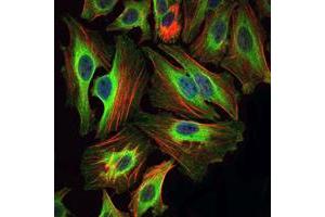 Immunofluorescence analysis of Hela cells using BID mouse mAb (green). (BID anticorps)