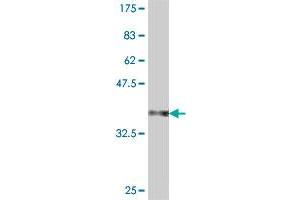 Western Blot detection against Immunogen (38.