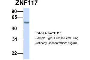 Host:  Rabbit  Target Name:  ZNF117  Sample Type:  Human Fetal Lung  Antibody Dilution:  1. (Zinc Finger Protein 117 anticorps  (N-Term))