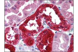 Image no. 1 for anti-Carbonic Anhydrase II (CA2) antibody (HRP) (ABIN372476)