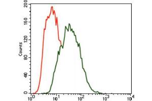 Immunohistochemical analysis of paraffin-embedded bladder cancer tissues using MARK3 antibody with DAB staining. (MARK3 anticorps  (AA 435-658))