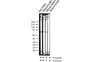 Western blot analysis of Phospho-CDC25B (Ser323) expression in various lysates