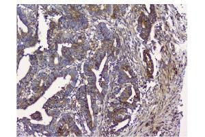 IHC analysis of NMI using anti-NMI antibody (ABIN3043451). (NMI anticorps  (AA 2-307))