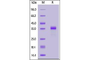 Biotinylated Human Gastrin-17, Fc,Avitag on  under reducing (R) condition.