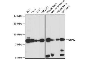 Western blot analysis of extracts of various cell lines, using GFPT2 antibody. (GFPT2 anticorps)