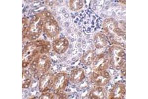 Immunohistochemistry (IHC) image for anti-Ankyrin Repeat Domain 54 (ANKRD54) (C-Term) antibody (ABIN1030482) (ANKRD54 anticorps  (C-Term))