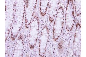 IHC-P Image Immunohistochemical analysis of paraffin-embedded human normal colon, using NUP50, antibody at 1:250 dilution.