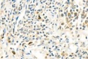 Immunohistochemistry analysis of paraffin-embedded human tonsil using,PARP1 (ABIN7075114) at dilution of 1: 750