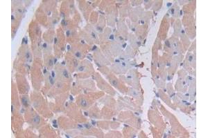 Detection of MYLK2 in Mouse Heart Tissue using Polyclonal Antibody to Myosin Light Chain Kinase 2 (MYLK2) (MYLK2 anticorps  (AA 330-548))