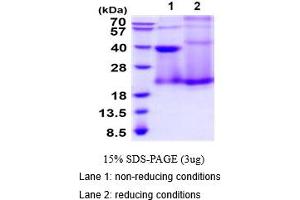 SDS-PAGE (SDS) image for CD70 Molecule (CD70) (AA 39-193) (Active) protein (His tag) (ABIN7281115)