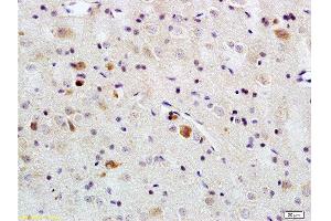Formalin-fixed and paraffin embedded rat brain tissue labeled with Rabbit Anti-PACAP-38 Polyclonal Antibody  , Unconjugated at 1:200 followed by conjugation to the secondary antibody and DAB staining.