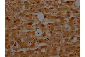 IHC image of ABIN7127348 diluted at 1:100 and staining in paraffin-embedded human liver tissue performed on a Leica BondTM system. (Recombinant ATF5 anticorps)