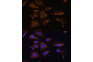 Immunofluorescence analysis of U-2 OS cells using RPS25 antibody (ABIN7270020) at dilution of 1:100. (RPS25 anticorps  (C-Term))