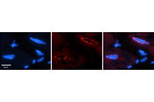 Rabbit Anti-TCF20 Antibody    Formalin Fixed Paraffin Embedded Tissue: Human Adult heart  Observed Staining: Nuclear (nuclear membrane) Primary Antibody Concentration: 1:100 Secondary Antibody: Donkey anti-Rabbit-Cy2/3 Secondary Antibody Concentration: 1:200 Magnification: 20X Exposure Time: 0. (TCF20 anticorps  (C-Term))