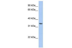 WB Suggested Anti-ZNF584 Antibody Titration:  0. (ZNF584 anticorps  (Middle Region))