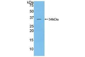 Detection of Recombinant TAF1, Human using Polyclonal Antibody to TATA Box Binding Protein Associated Factor 1 (TAF1)