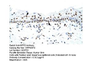 Rabbit Anti-SFPQ Antibody  Paraffin Embedded Tissue: Human Skin Cellular Data: Squamous epithelial cells Antibody Concentration: 4. (SFPQ anticorps  (N-Term))